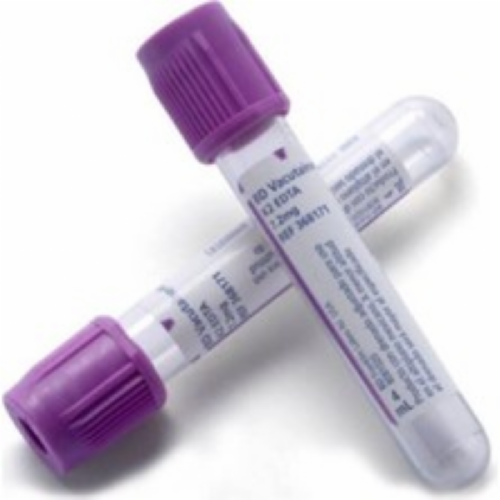 Ayset Kan Toplama Tüpü Vakumlu 3 Ml Mor